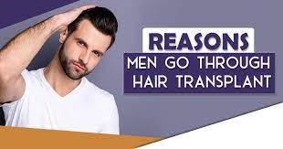 Side effects of hair transplant