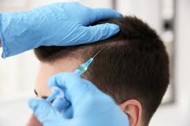 Factors to Consider When Choosing a Hair Transplant Clinic
