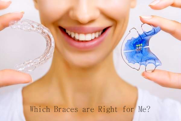 Which braces are right for me?