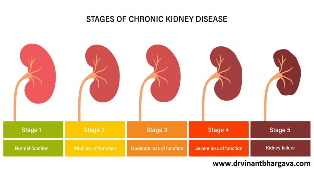 chronic kidney failure