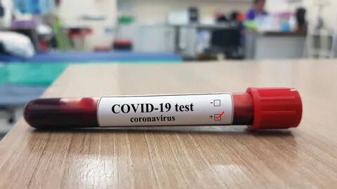 COVID-19 Rapid Testing